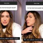 “Se eu fizesse harmonização facial meu nariz não ia ser torto, eu ia ter tudo aqui marcado”, explicou. (Foto: Instagram)