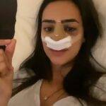 Em seu perfil no TikTok, ela compartilhou todos os passos do procedimento, mostrando cliques tirados antes, durante e depois da rinoplastia (Foto: Tiktok)