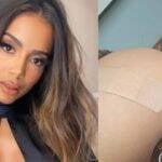 Anitta toma terceira dose da vacina e provoca: “Será que é agora que viro jacaré?” (Foto: Instagram)