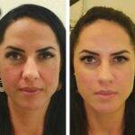 Graciele Barbosa realizou a harmonização facial focando em suas bochechas, para deixar seu rosto mais assimétrico. (Foto: Instagram)
