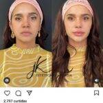 A bela fez uma harmonização facial (Foto: Instagram)