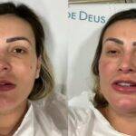 Andressa Urach falou mais sobre seu estado de saúde (Foto: Instagram)