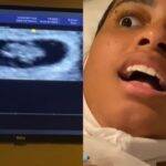 MC Loma arrancou risos dos fãs ao postar um vídeo em seu primeiro ultrassom (Foto: Instagram)