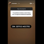 “Você poderia mostrar como ficou sua cirurgia de abdominoplastia?”, perguntou outro fã. (Foto: Instagram)