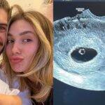 Virginia mostra primeiro ultrassom de segundo filho com Zé Felipe (Foto: Instagram)