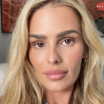 Yasmin Brunet revelou que já teve depressão na adolescência (Foto: Instagram)