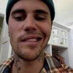 Justin Bieber publicou um vídeo mostrando seu rosto parcialmente paralisado. (Foto: Instagram)