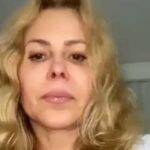 Devido a doença, Joelma teve um edema, além de gastrite e esofagite. (Foto: Instagram)