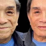 O comediante Dedé Santana, de 86 anos, realizou uma harmonização facial. (Foto: Instagram)