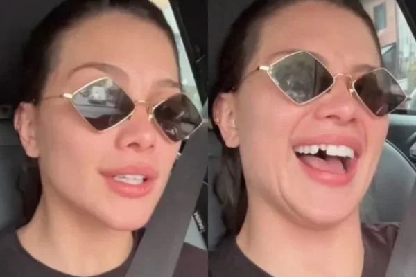 Flávia Pavanelli Assusta Os Fãs Com Queimadura No Rosto Jetss 