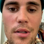 No ano passado, Justin Bieber usou as redes sociais para informar aos fãs que foi diagnosticado com a síndrome de Ramsay Hunt, causada pelo vírus Herpes-zóster. (Foto: Reprodução/Instagram)