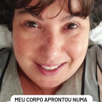 A doença de Mariana pode causar muita dor já que ela caracteriza-se pela infecção dolorosa de um único nervo sensorial em um lado do corpo que pode acontecer quase em qualquer lugar, mas é mais comum no tronco ou na face. (Foto: Reprodução/Instagram)