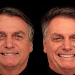 Jair Bolsonaro (PL) se submeteu a um procedimento de harmonização facial do sorriso e do rosto nas últimas semanas. (Fotos: Divulgação/Montagem)