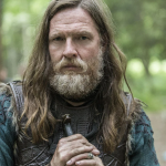 Donal logue - ator, produtor e escritor que atuou em “Sons of Anarchy” e “Vikings”, foi diagnosticado com um carcinoma de células escamosas em sua testa em 2014. (Foto: Divulgação)