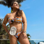 Com o objetivo de conscientizar outras mulher3s e servir de imagem para as que passam pelo mesmo problema, Preta Gil também deu uma importante lição sobre a normalização do uso da bolsa de ileostomia, que usou por um tempo no seu processo de cura do câncer. (Foto: Instagram)