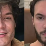 Antes e depois de Eliezer após desfazer a harmonização facial. (Foto: Reprodução/Instagram)