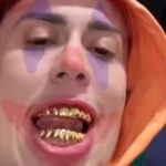 Ele exibiu três modelos diferentes de grillz: um de prata banhado em ouro de 18 quilates, avaliado em R$11,9 mil; outro de prata banhado em ouro rosé, no valor de R$15,1 mil; e um grillz de prata 950 cravejado de zircônias, que custa cerca de R$13,5 mil. (Foto: Instagram)