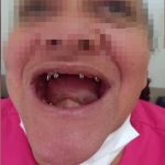 Rubiane Marques, 45 anos, iniciou um procedimento de implante dentário há mais de um ano e relata sua experiência. (Foto: PCGO)