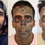 A segunda sessão de remoção das tatuagens faciais ocorreu em 3 de julho, com oito sessões previstas a cada três meses para remover todas as tatuagens do seu corpo, que estava 95% tatuado. (Foto: Instagram)