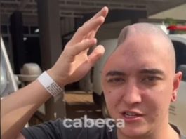 Devido ao acidente, parte de seu crânio precisou ser temporariamente armazenada em seu abdômen. (Foto: TikTok)