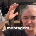 Como muitos hospitais não possuem banco de ossos, a calota foi armazenada no abdômen para preservar contra infecções.(Foto: TikTok)