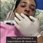 Desde o ataque, Larissa acorda todos os dias revivendo o terror, incapaz de ficar sozinha, e sua filha ainda sofre com o impacto psicológico. (Foto: Instagram)