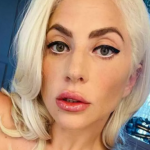 Em 2018, Lady Gaga revelou em entrevista à revista americana Arthritis que sofre de artrite reumatoide. (Foto: Instagram)