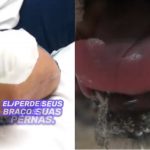 Kathy Roberts foi mordida pelo animal enquanto lhe oferecia um pedaço de frango e, inicialmente, o pequeno arranhão não parecia preocupante. (Foto: TikTok)