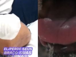 Kathy Roberts foi mordida pelo animal enquanto lhe oferecia um pedaço de frango e, inicialmente, o pequeno arranhão não parecia preocupante. (Foto: TikTok)