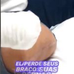 Depois de limpar e aplicar pomada, Kathy não imaginava as complicações que surgiriam. (Foto: TikTok)