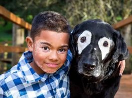 Há dois anos, Carter notou manchas brancas aparecendo em seu rosto, sinais do vitiligo — uma condição que afeta a pigmentação da pele. (Foto: Instagram)