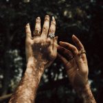 Em 2009, o homem consultou um especialista que o alertou sobre a possível relação entre o vitiligo e a saúde emocional. (Foto: Unsplash)