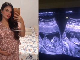 Mulher realiza exame de saúde para concurso público e descobre gravidez de gêmeos (Foto: Instagram)