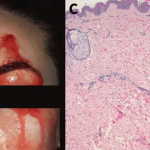 Imagine acordar de um sono tranquilo e encontrar seu rosto e mãos cobertos de sangue. (Foto: Reprodução)