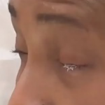 Mulher acidentalmente cola os olhos após confundir cola de unha com colírio. (Foto: Reprodução/TikTok)