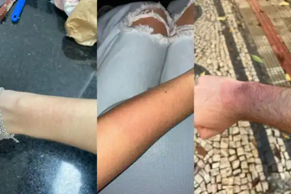 Show de Luan Santana em BH termina com fãs com queimaduras após vazamento em pulseiras