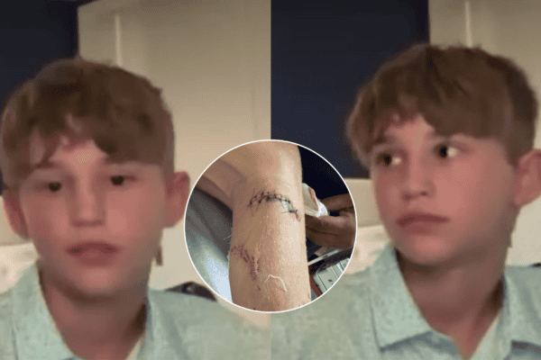 Terror! Criança é atacada por tubarão durante férias